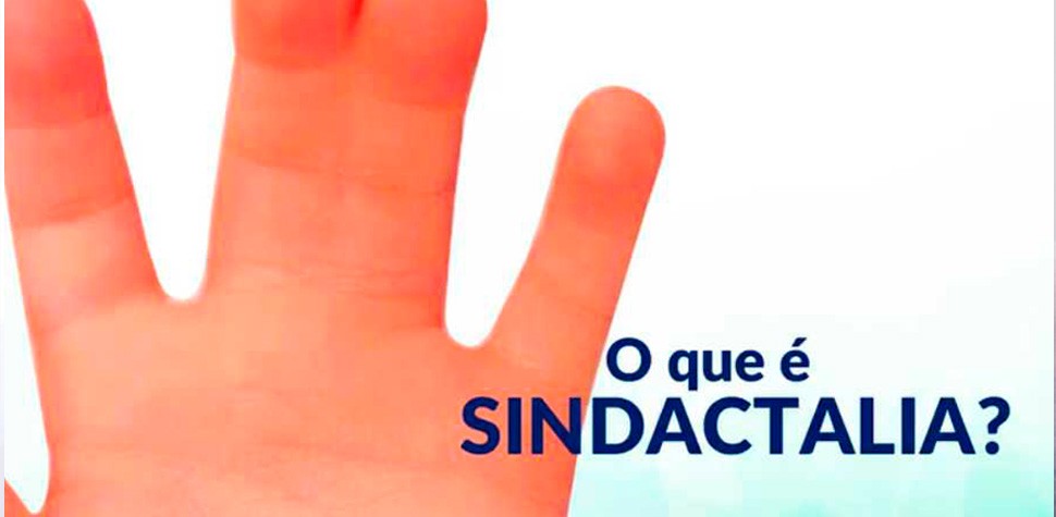 sindactilia2