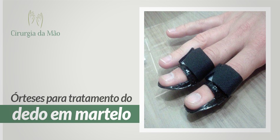 banner-tratamento-dedo-martelo-cirurgia-das-maos-2